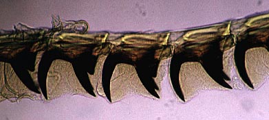 Photo : Dtails des dents sur la radula d'un chiton